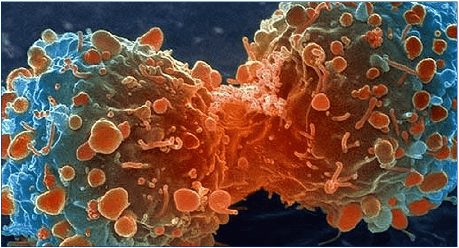 ¿Qué es el cancer? - LifEscozul&reg;