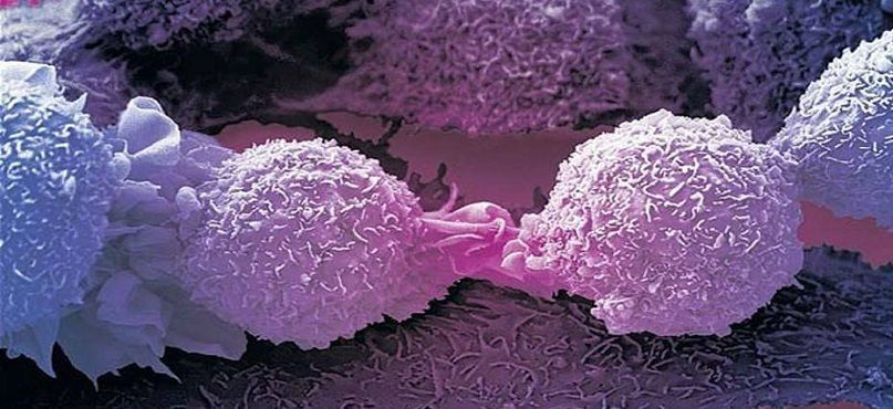 LifEscozul&reg; - Melanoma