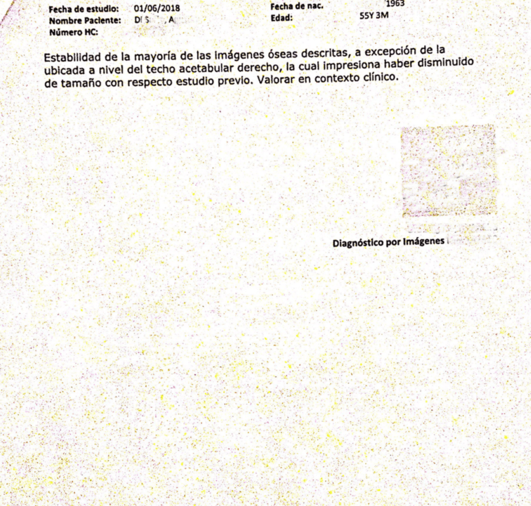 LifEscozul® - A.D.S. 17 - Cáncer de Pulmon