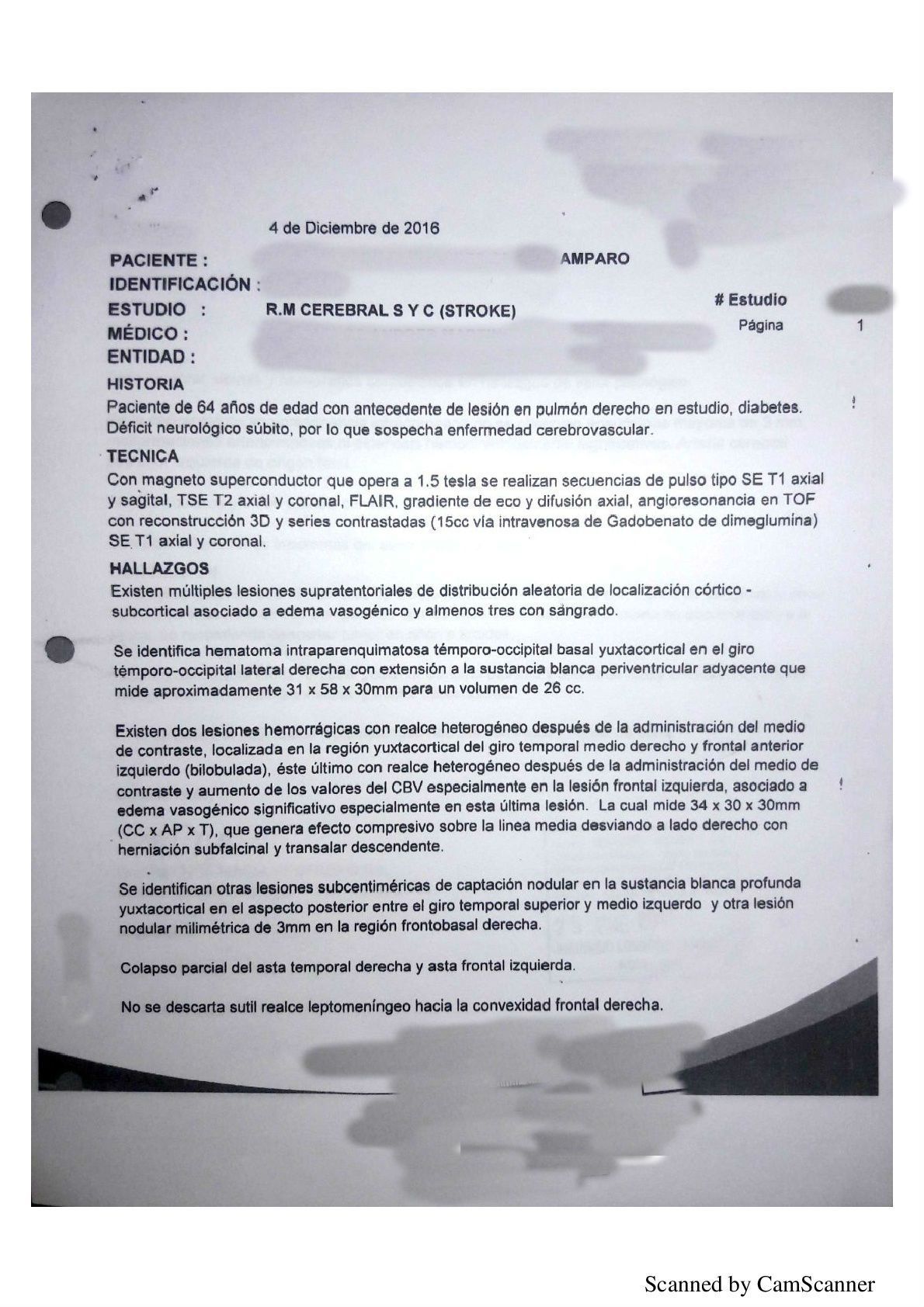 LifEscozul® - Amparo 1 - Cáncer de Pulmon