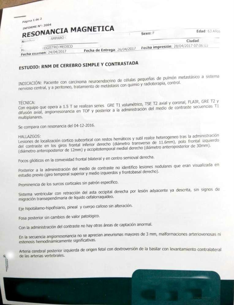 LifEscozul® - Amparo 4 - Cáncer de Pulmon