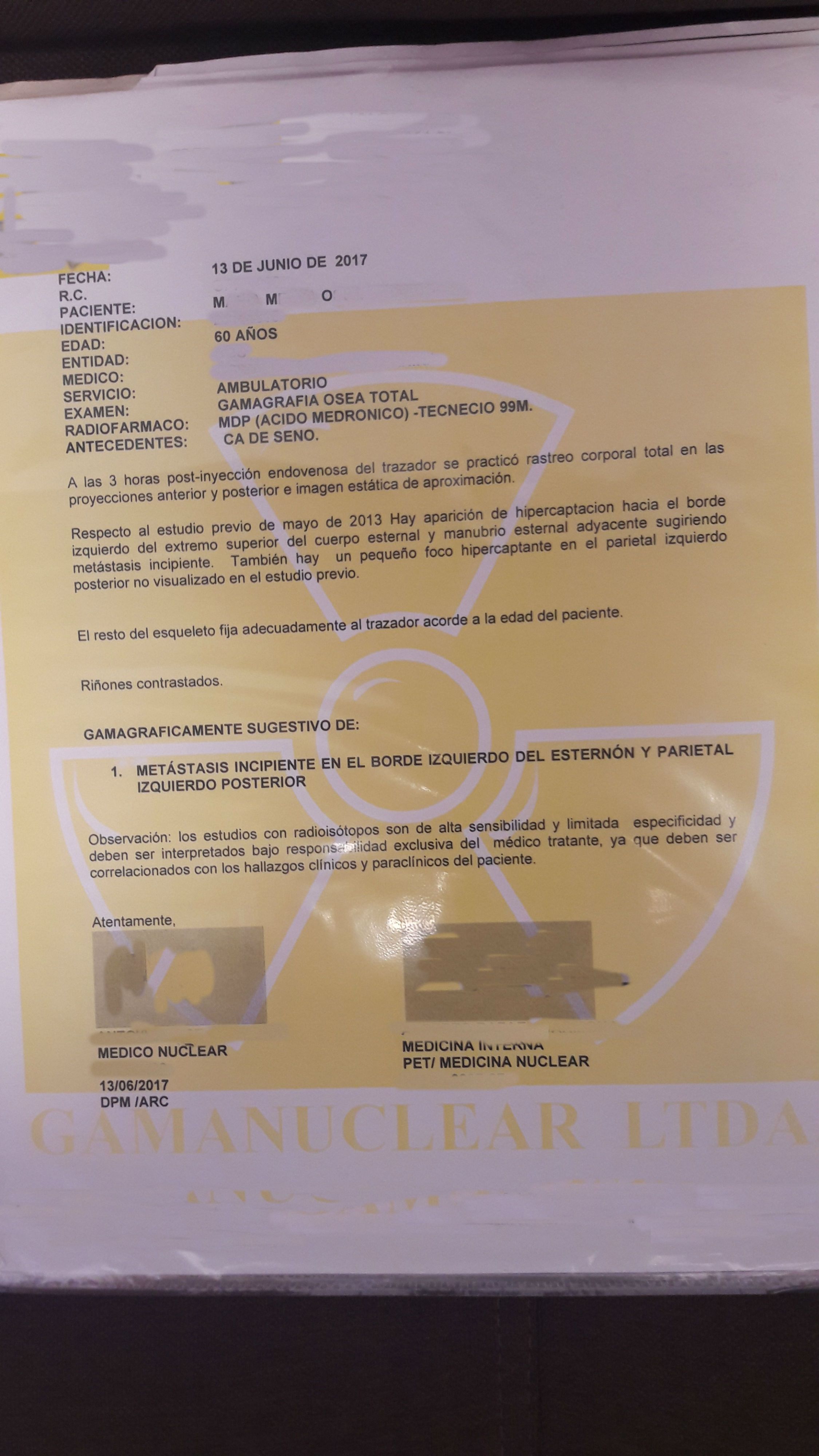 LifEscozul&reg; - M.M.O. 2 - Cáncer de Mámas