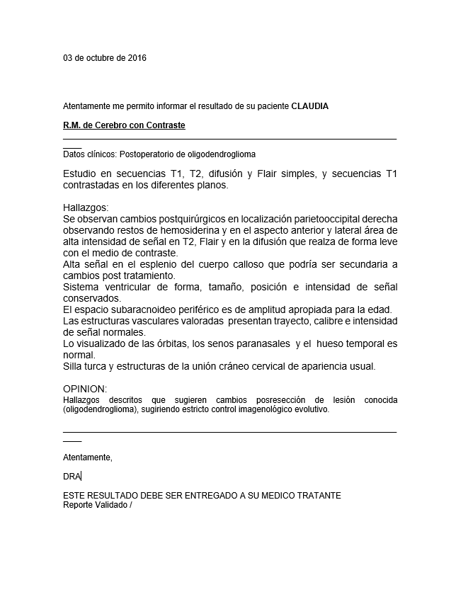 LifEscozul&reg; - Claudia - Cáncer Cerebral