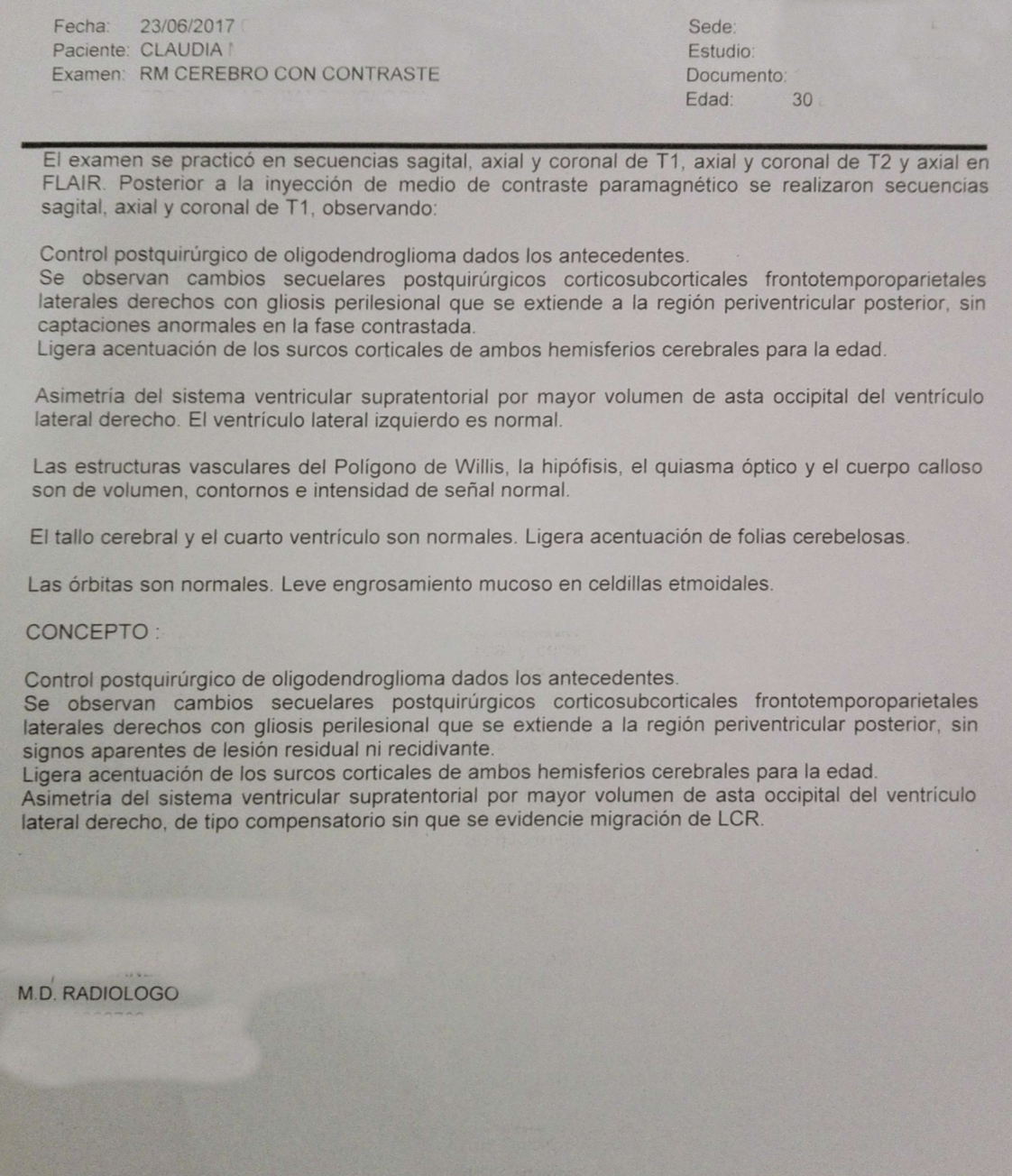 LifEscozul&reg; - Claudia - Cáncer Cerebral