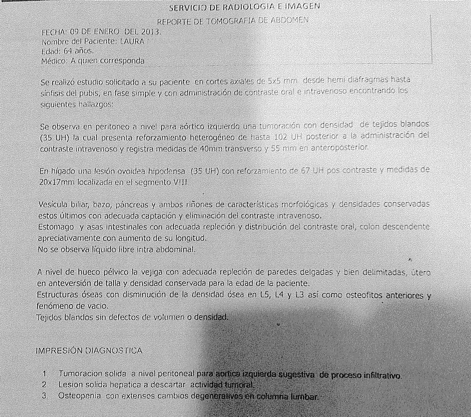 LifEscozul® - Laura 1 - Cáncer de Páncreas
