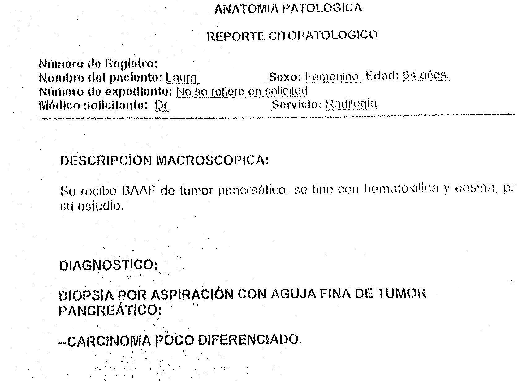 LifEscozul® - Laura 9 - Cáncer de Páncreas