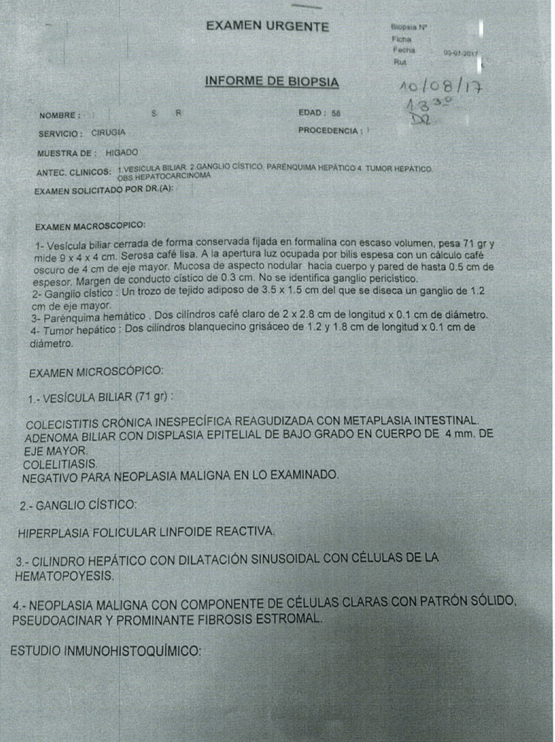 LifEscozul&reg; - S.R. 1 - Cáncer de Hígado