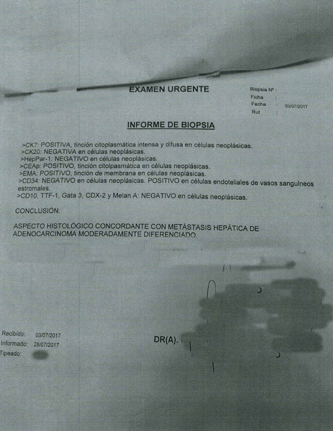 LifEscozul&reg; - S.R. 2 - Cáncer de Hígado