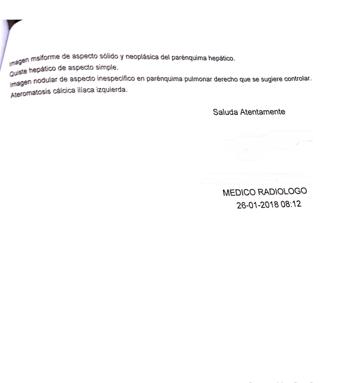 LifEscozul&reg; - S.R. 7 - Cáncer de Hígado