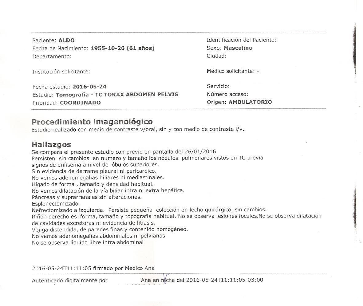 LifEscozul® - Aldo 10 - Cáncer de Riñon