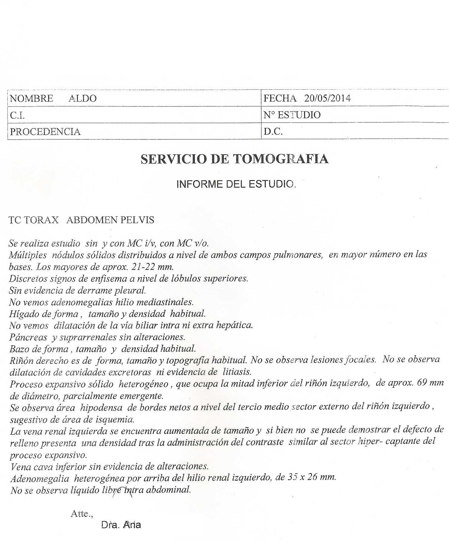 LifEscozul® - Aldo 9 - Cáncer de Riñon