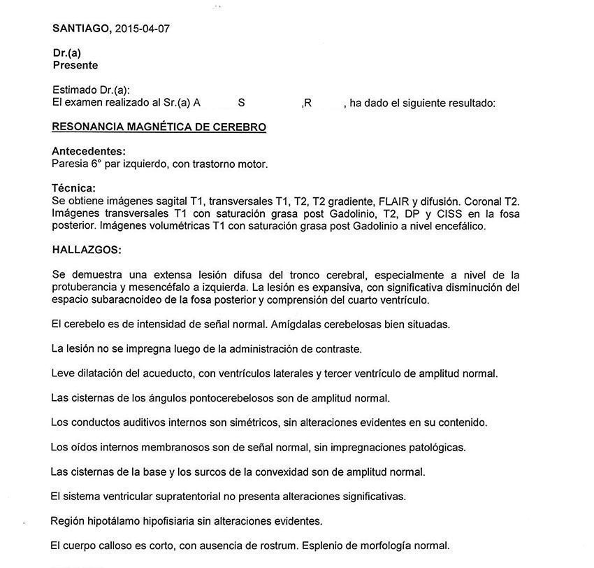 LifEscozul&reg; - R.A. 4 - Cáncer Cerebral