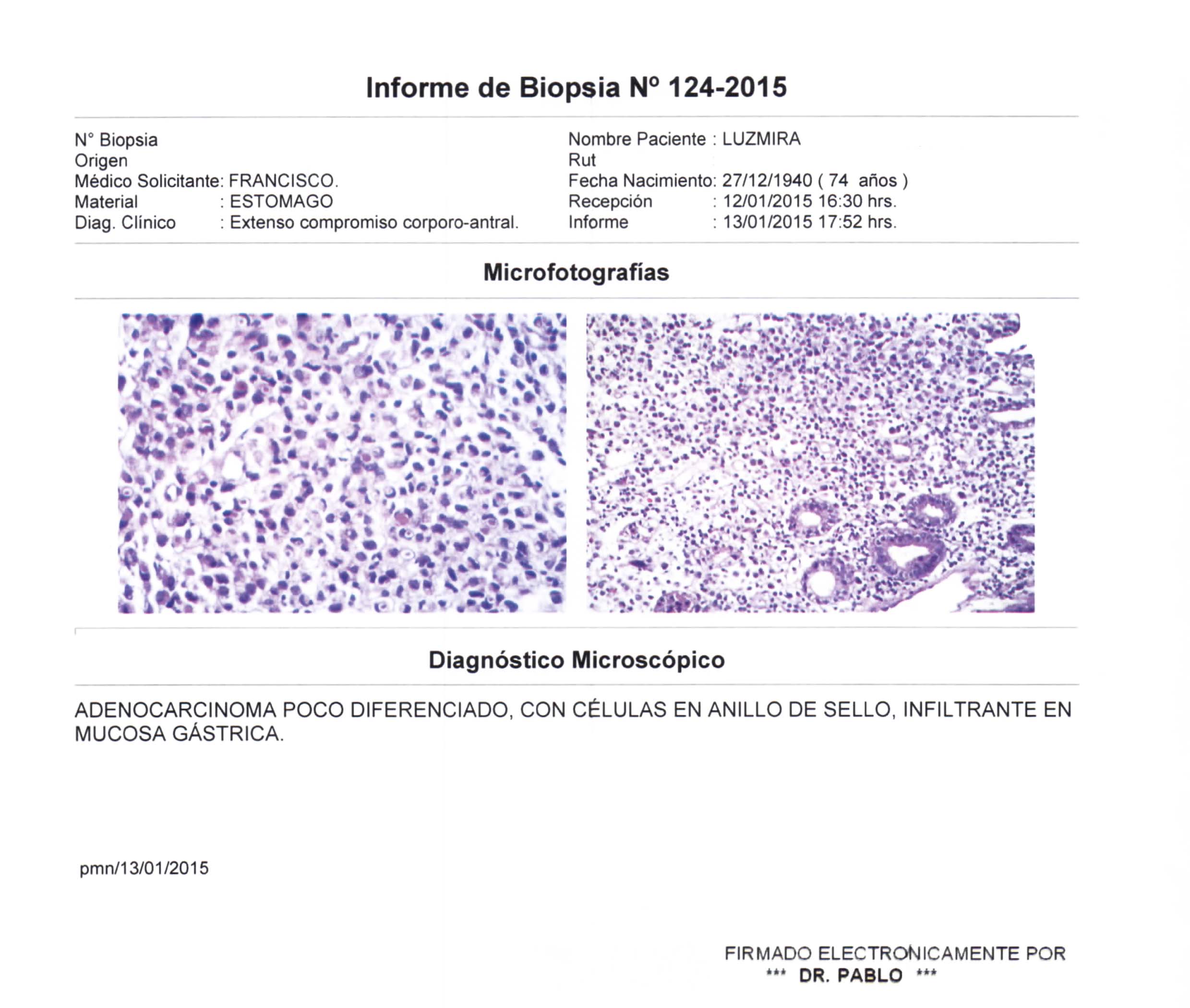 LifEscozul&reg; - Luzmira 12 - Cáncer Gástrico Intestinal