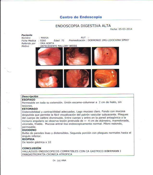 LifEscozul&reg; - María 2 - Cáncer Gástrico Intestinal