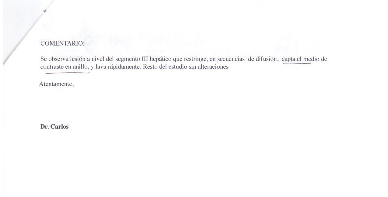 LifEscozul&reg; - María Cristina 1 - Cáncer de Mámas