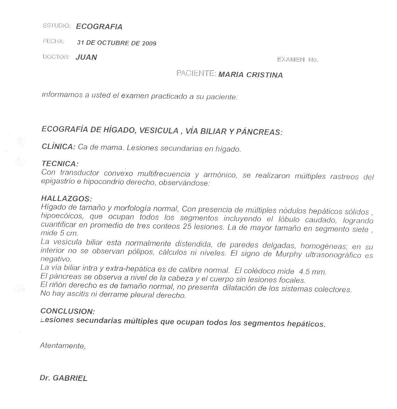 LifEscozul&reg; - María Cristina 2 - Cáncer de Mámas
