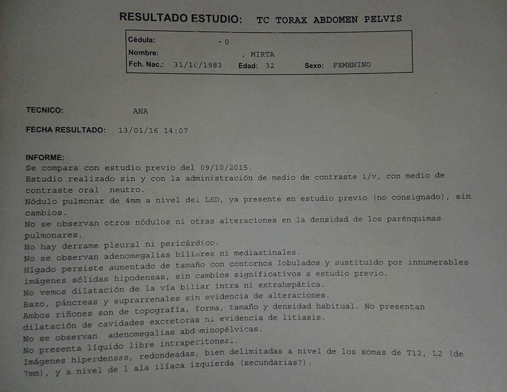 LifEscozul&reg; - Mirta 1 - Cáncer de Mámas