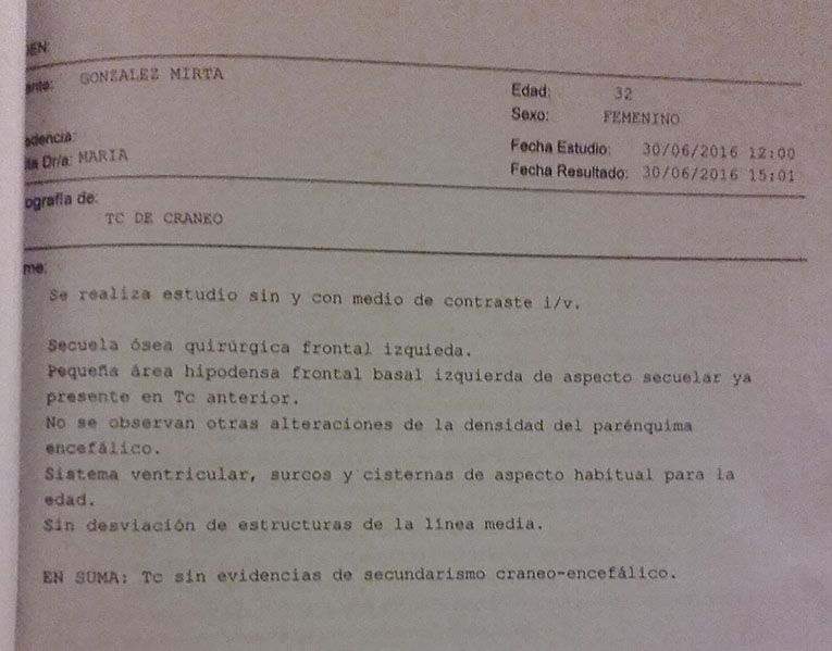 LifEscozul&reg; - Mirta 4 - Cáncer de Mámas