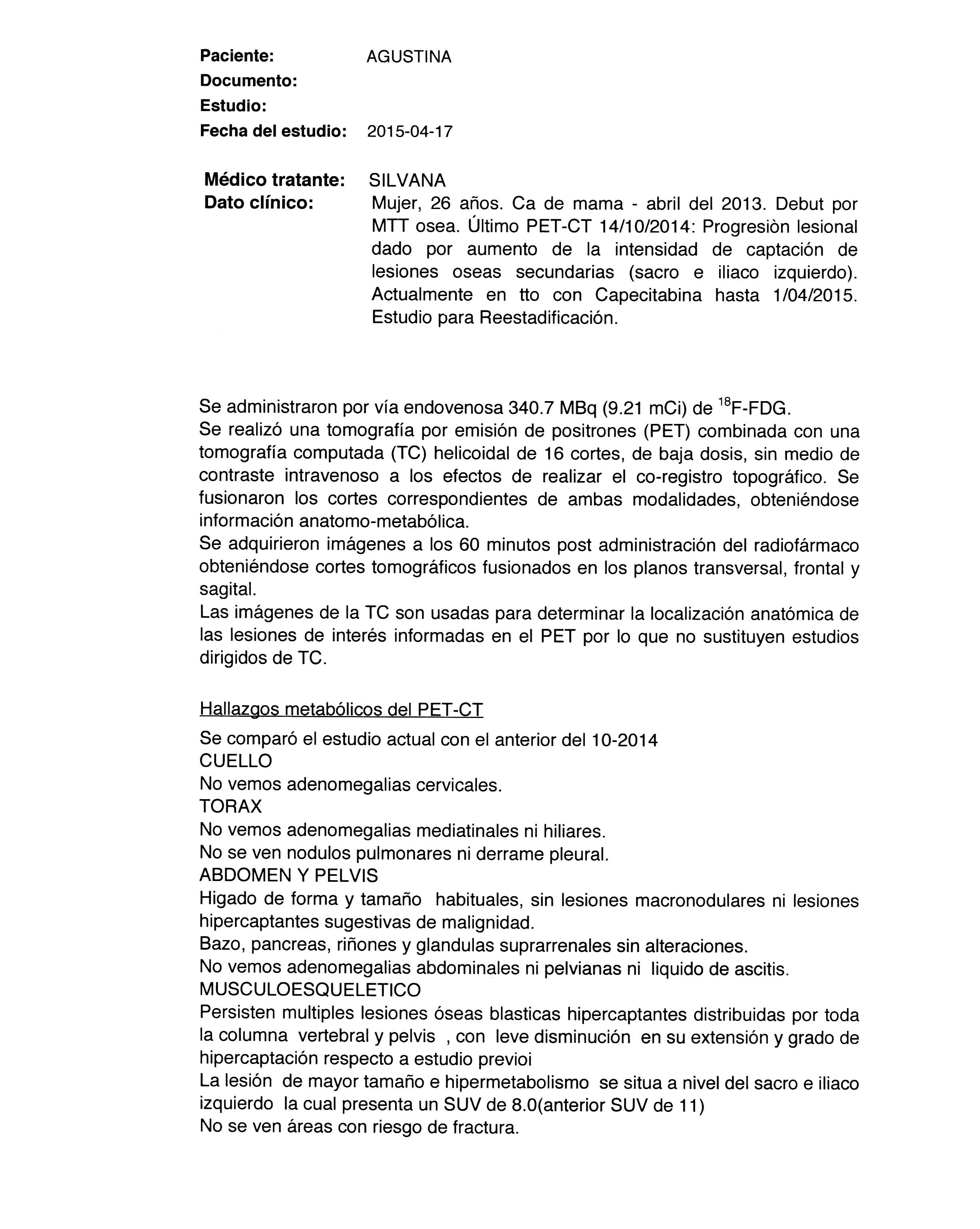 LifEscozul&reg; - Agustina 10 - Cáncer de Mámas