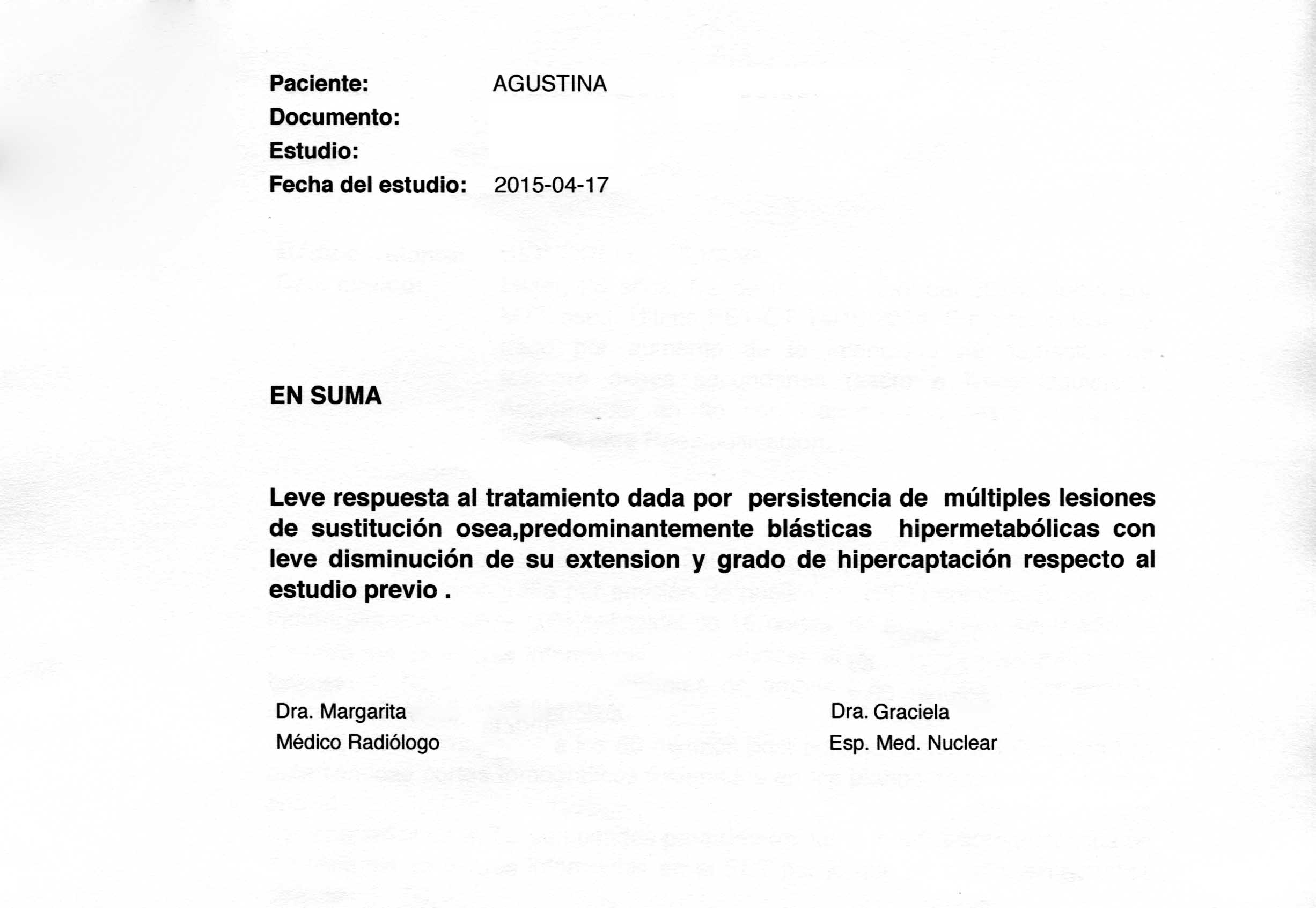 LifEscozul&reg; - Agustina 11 - Cáncer de Mámas