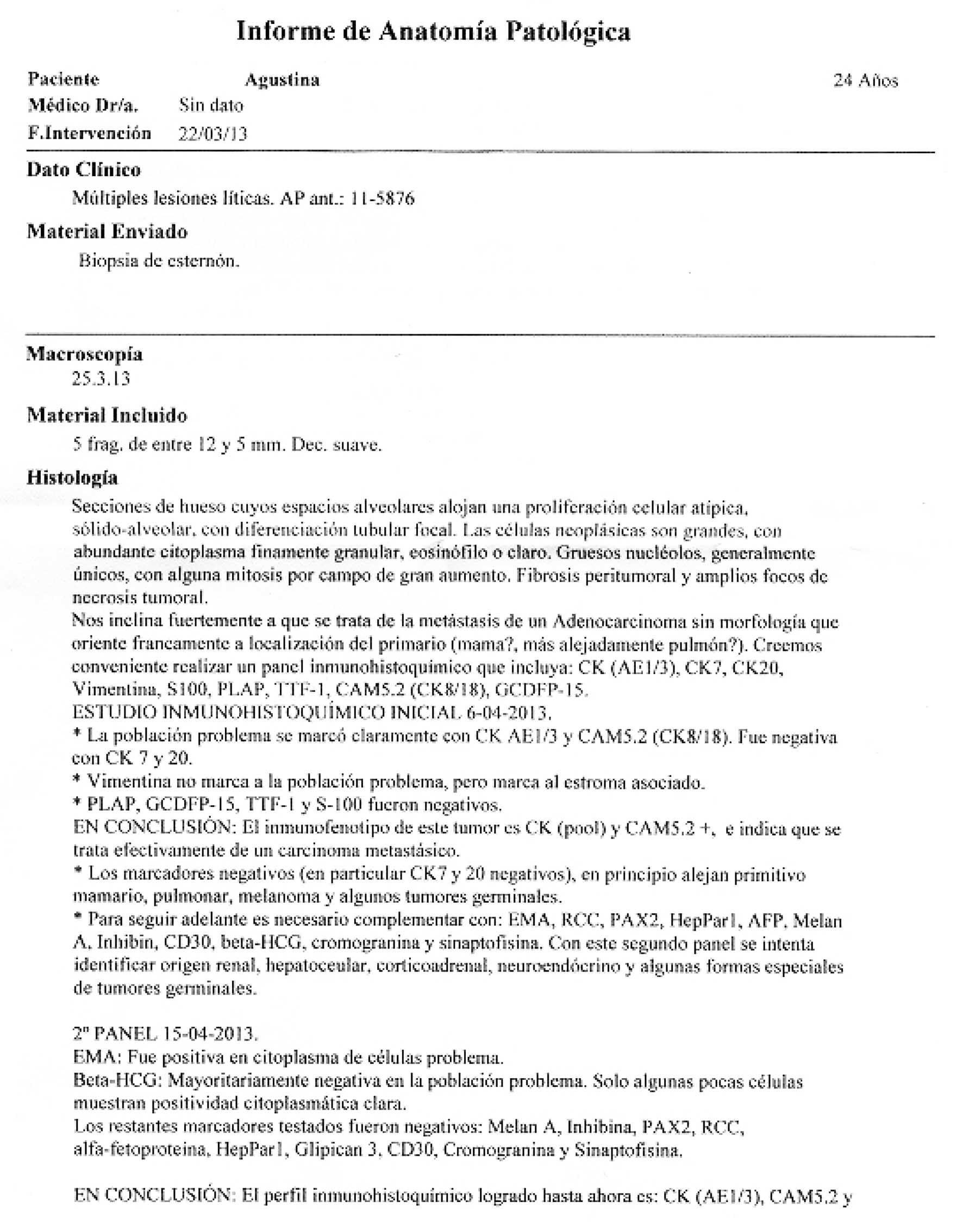 LifEscozul&reg; - Agustina 4 - Cáncer de Mámas