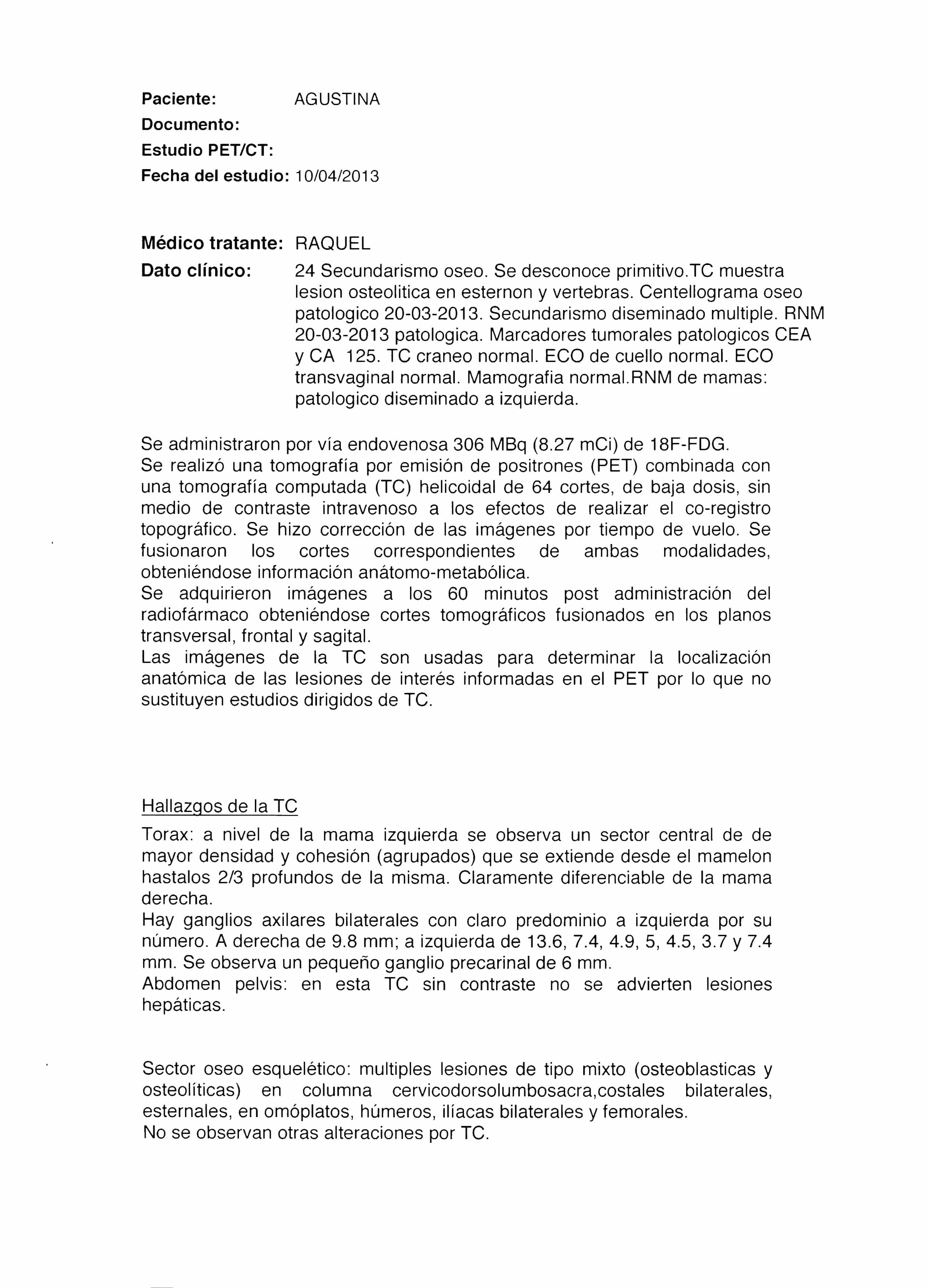 LifEscozul&reg; - Agustina 6 - Cáncer de Mámas