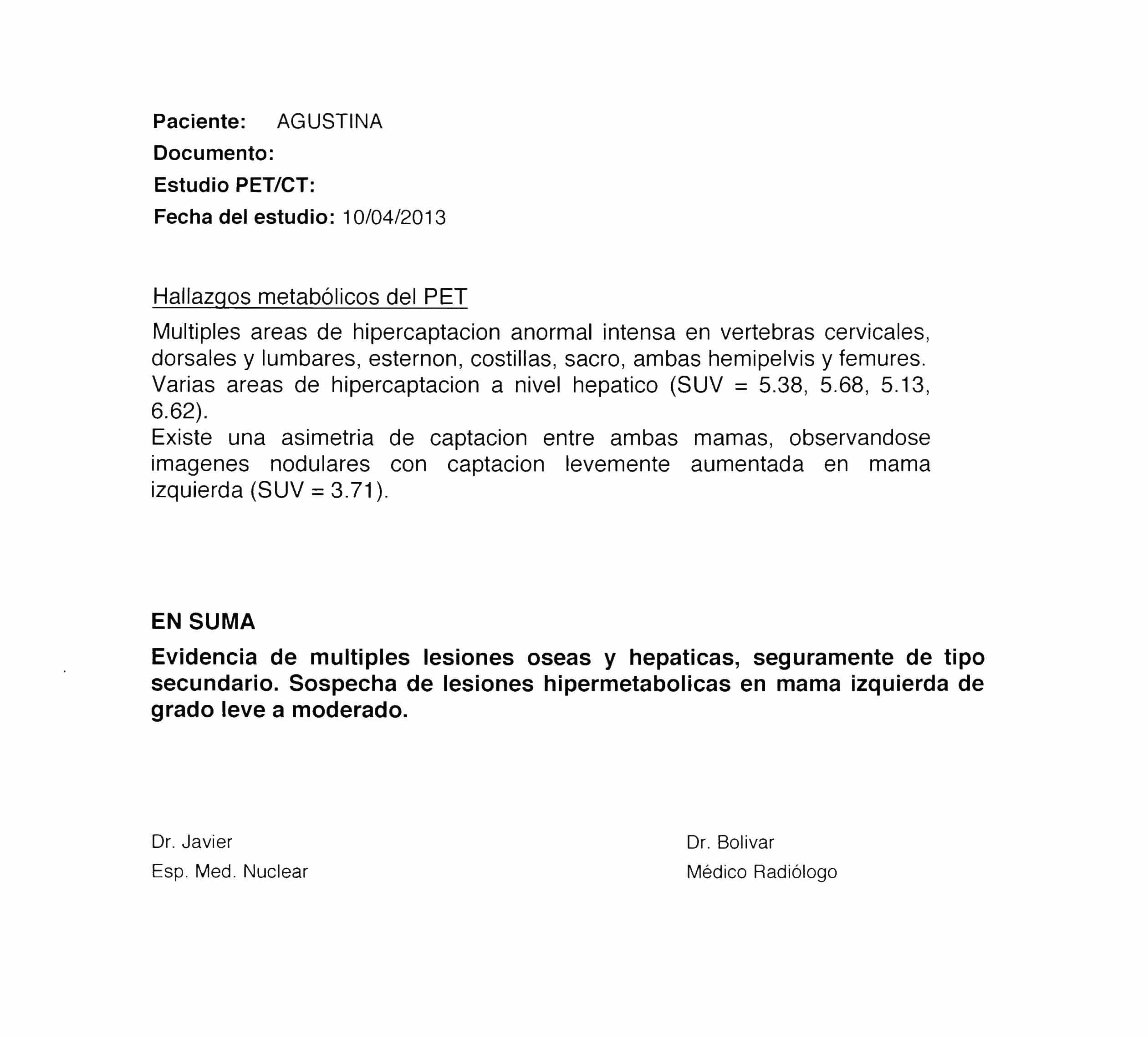 LifEscozul&reg; - Agustina 7 - Cáncer de Mámas
