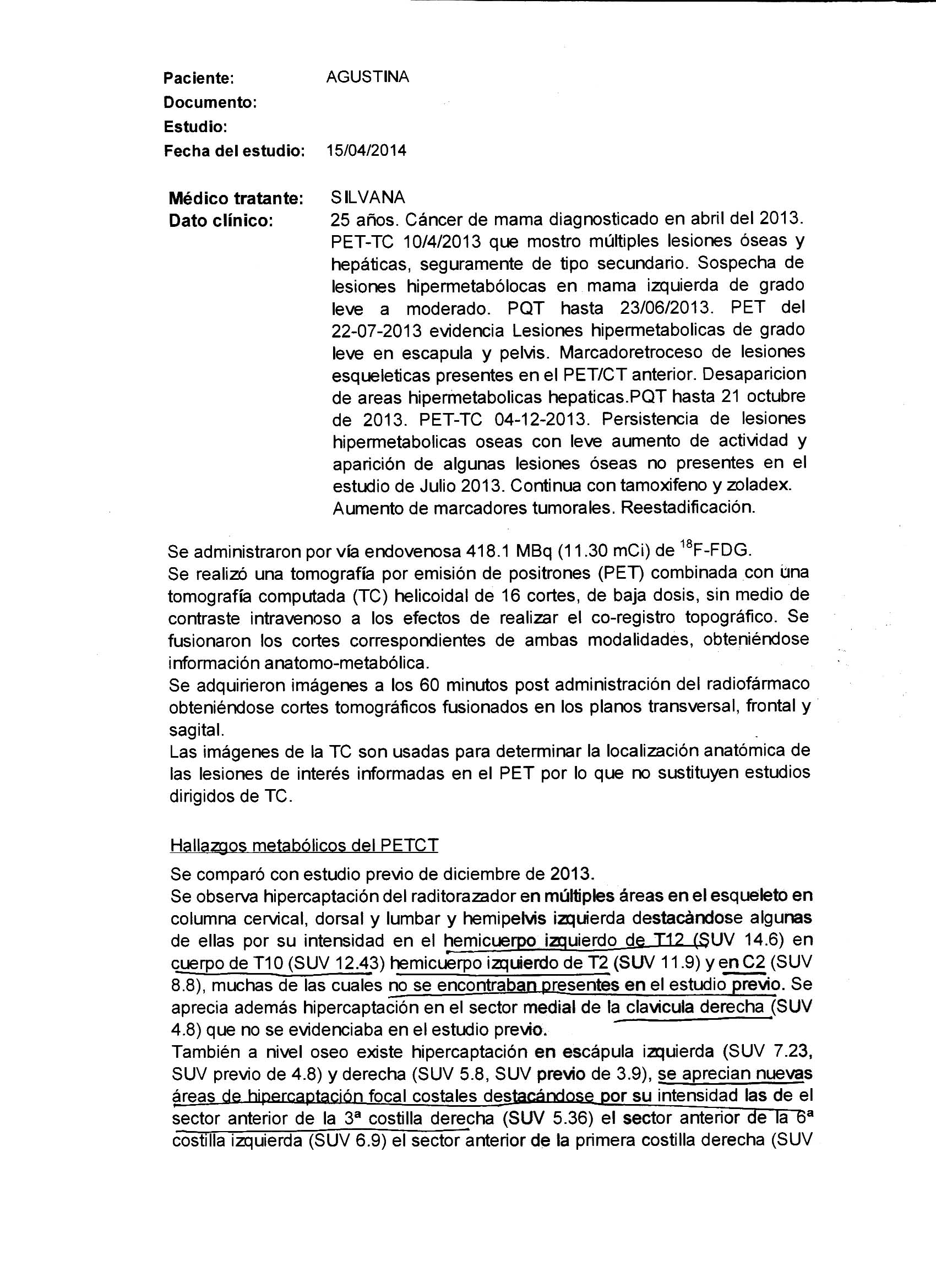 LifEscozul&reg; - Agustina 8 - Cáncer de Mámas