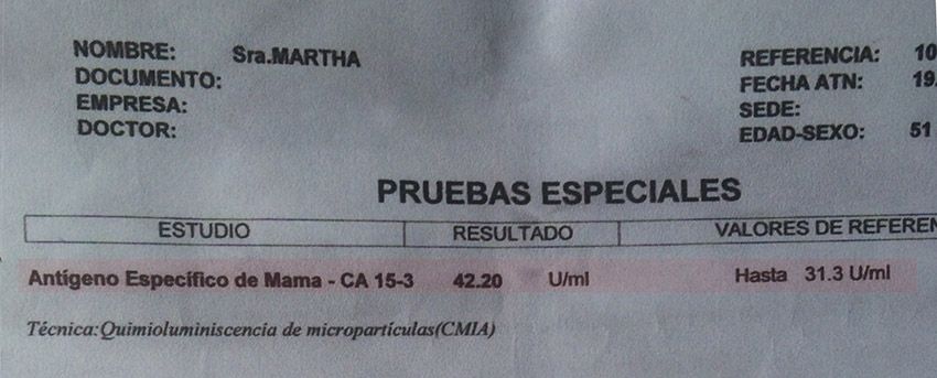 LifEscozul&reg; - Martha 7 - Cáncer de Mámas