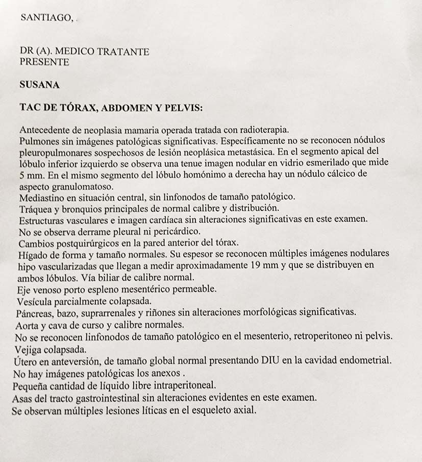 LifEscozul&reg; - Susana 44a 2 - Cáncer de Mámas