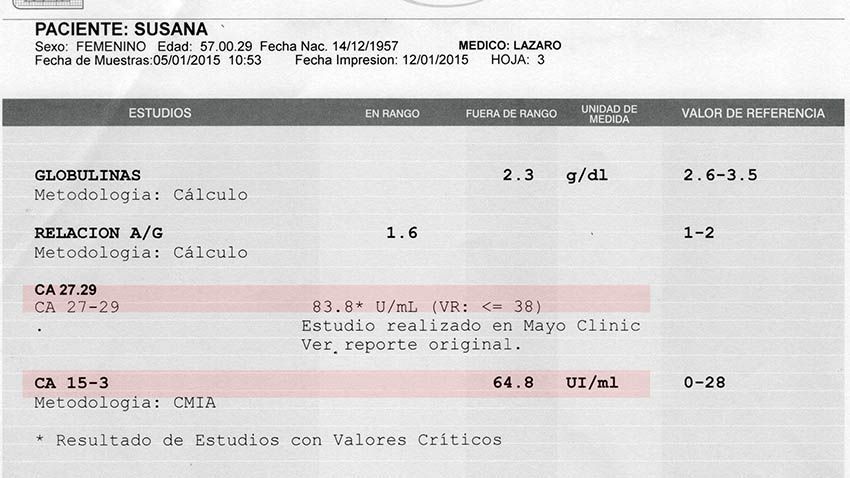 LifEscozul&reg; - Susana 1 - Cáncer de Mámas