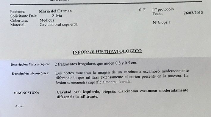 LifEscozul® - María del Carmen 1 - Cáncer Maxilar