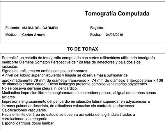 LifEscozul® - María del Carmen 1 - Cáncer Maxilar