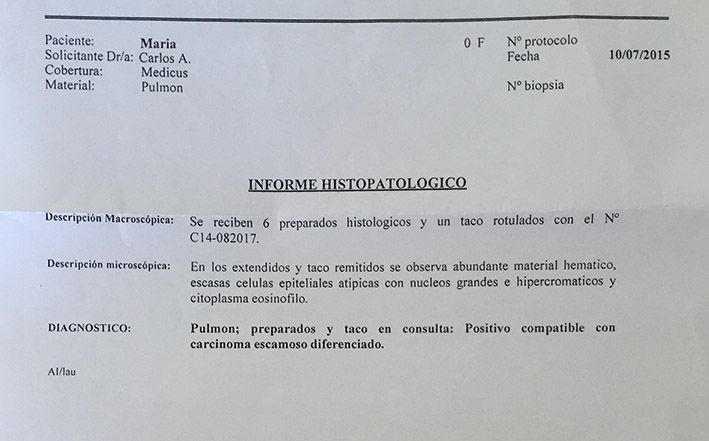 LifEscozul® - María del Carmen 1 - Cáncer Maxilar
