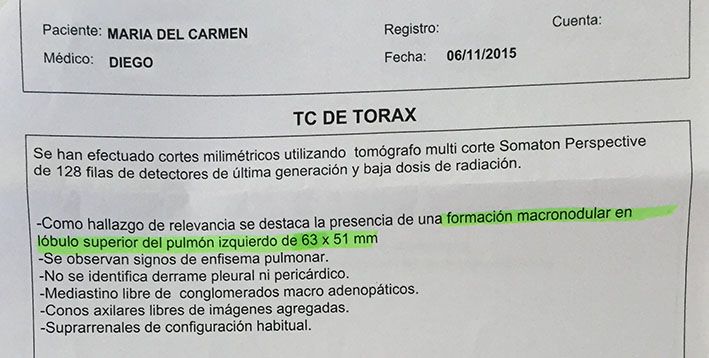 LifEscozul® - María del Carmen 1 - Cáncer Maxilar