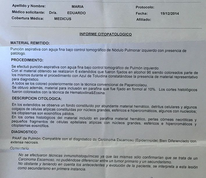 LifEscozul® - María del Carmen 1 - Cáncer Maxilar