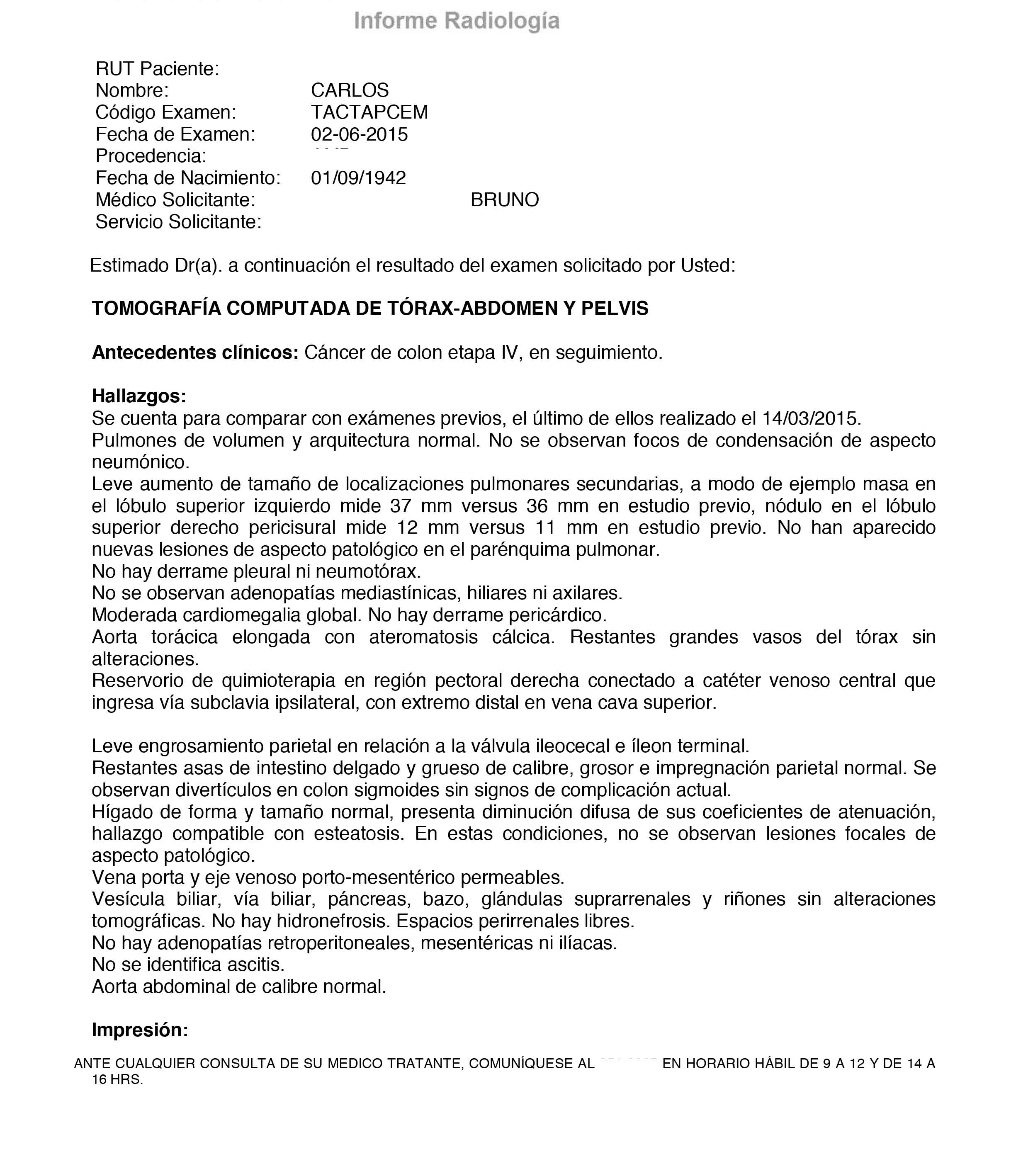 LifEscozul&reg; - Carlos 1 - Cáncer de Cólon