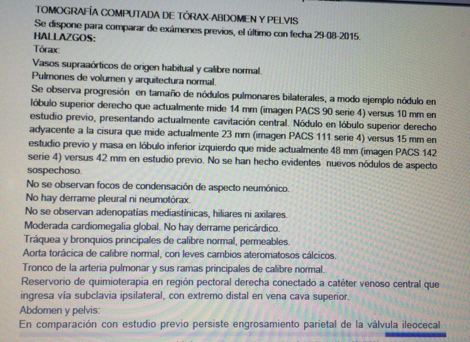 LifEscozul&reg; - Carlos 5 - Cáncer de Cólon