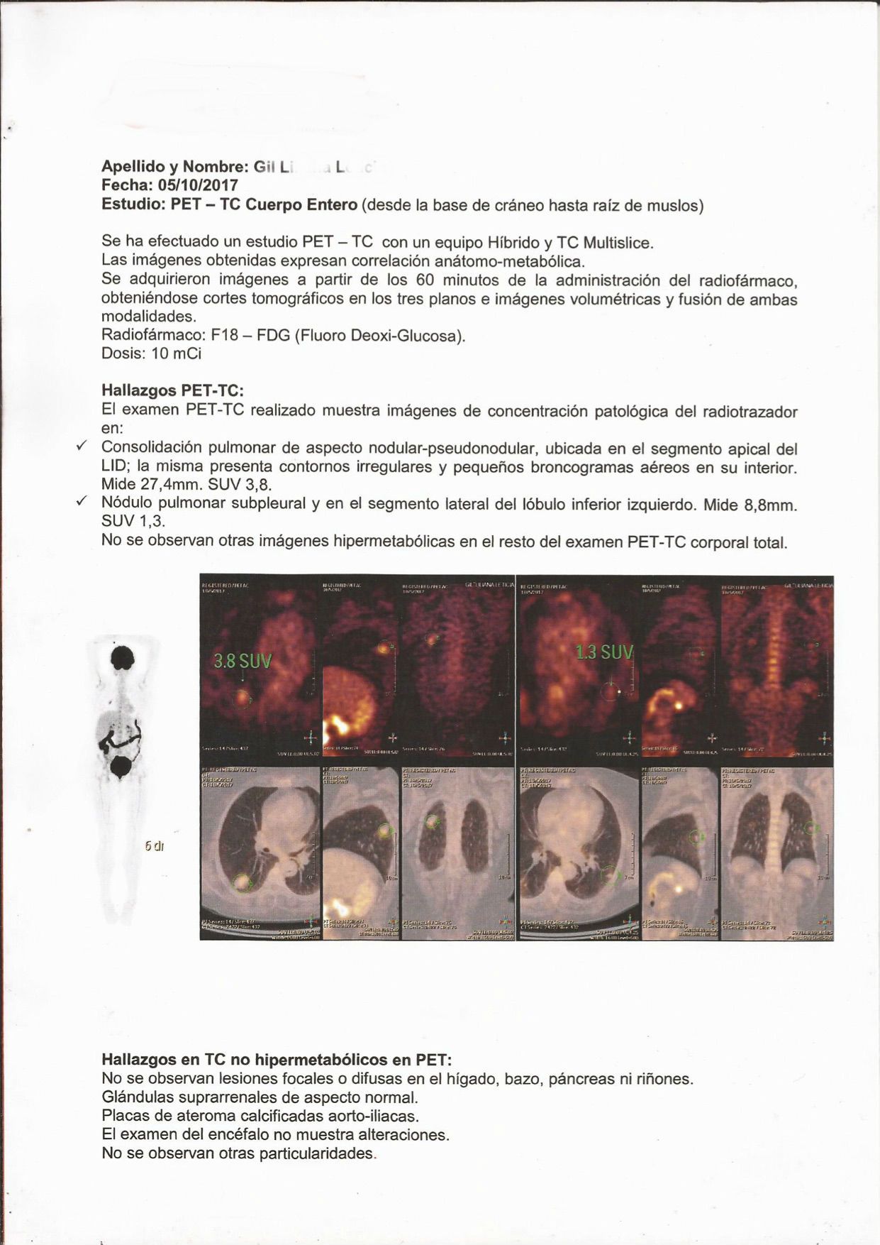 LifEscozul® - L.L.G 3 - Cáncer de Pulmon
