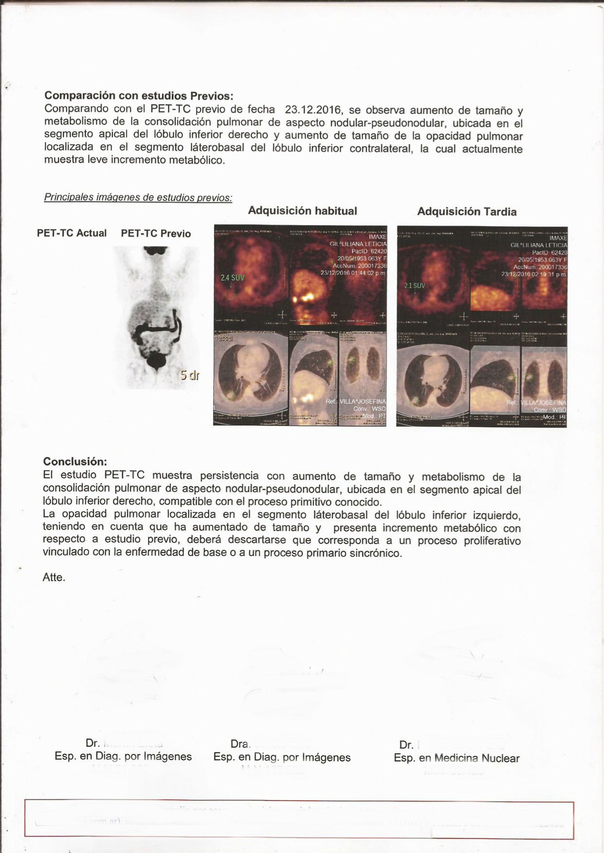 LifEscozul® - L.L.G 4 - Cáncer de Pulmon