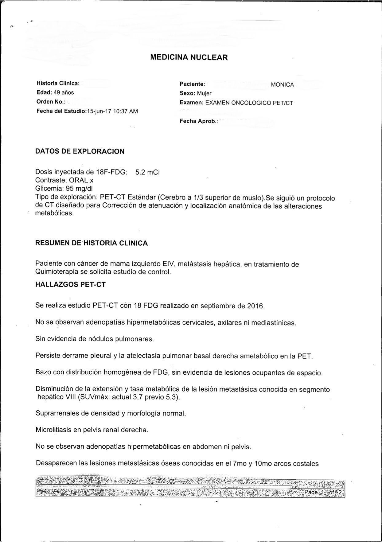 LifEscozul&reg; - Mónica 1 - Cáncer de Mámas