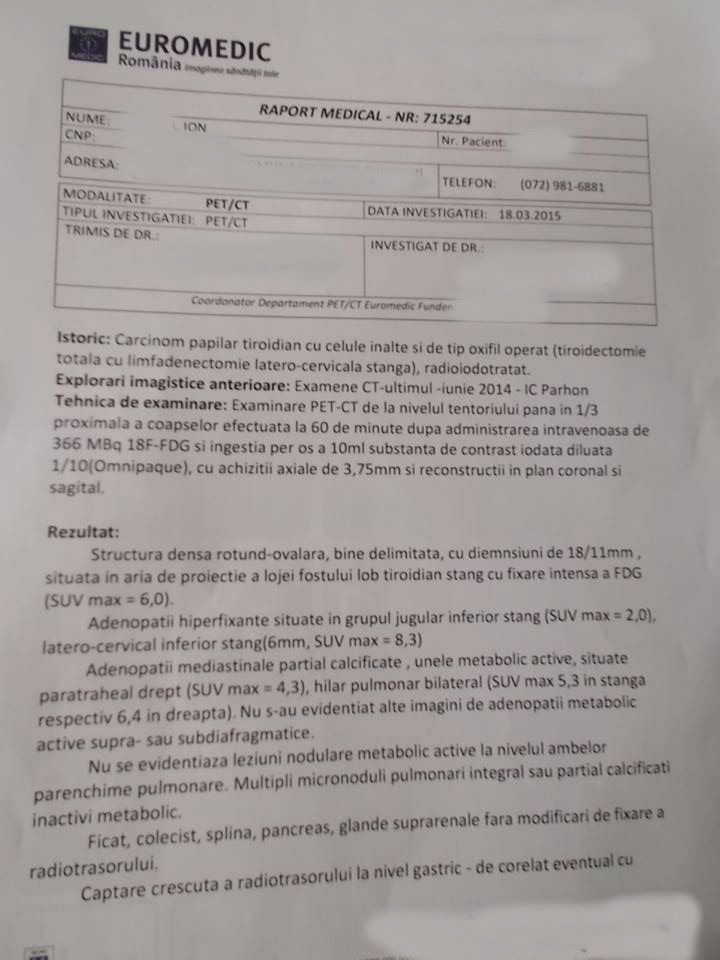 LifEscozul&reg; - Ion 11 - Cáncer de Tiroides