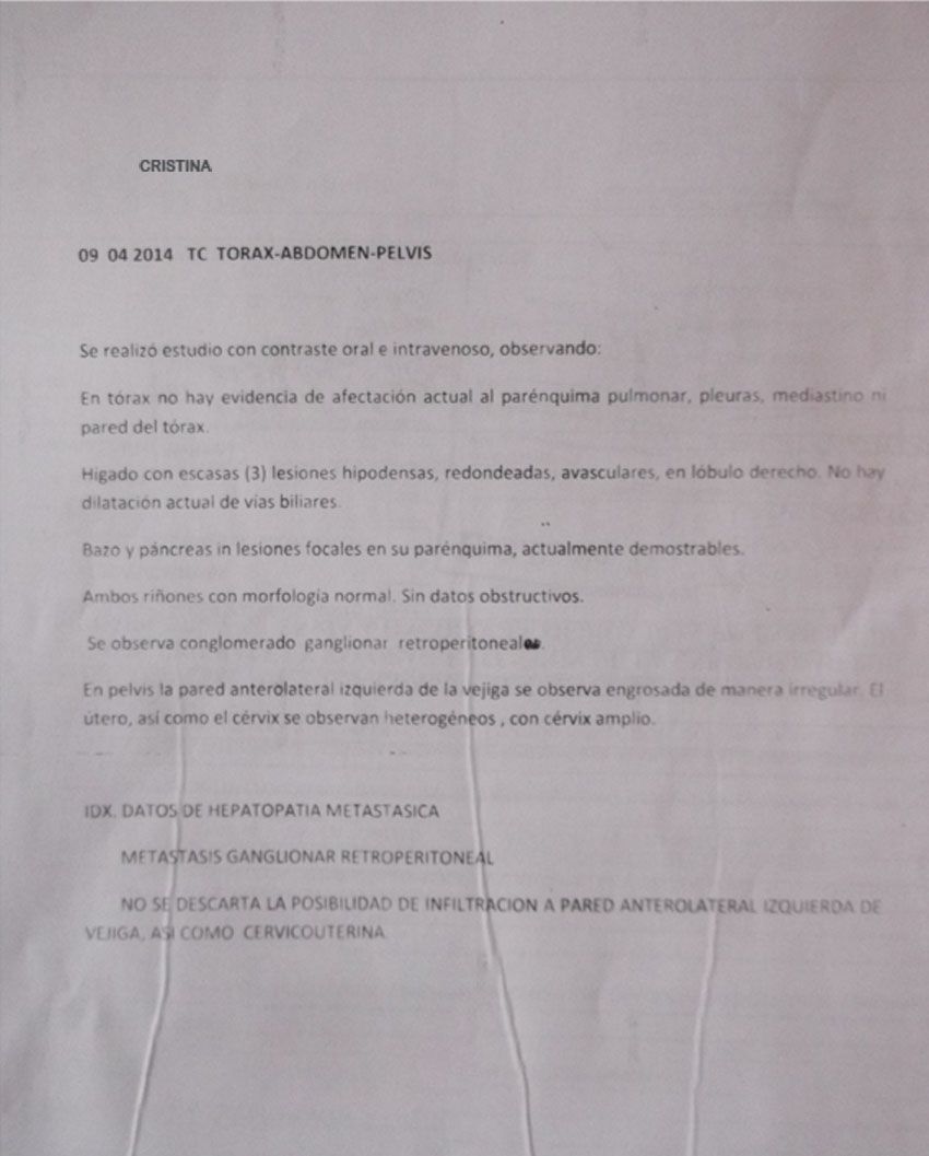 LifEscozul® - Cristina 3 - Cáncer de Ovarios