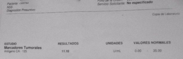LifEscozul® - Cristina 6 - Cáncer de Ovarios