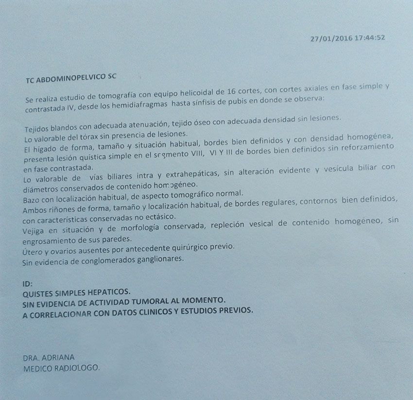 LifEscozul® - Cristina 8 - Cáncer de Ovarios