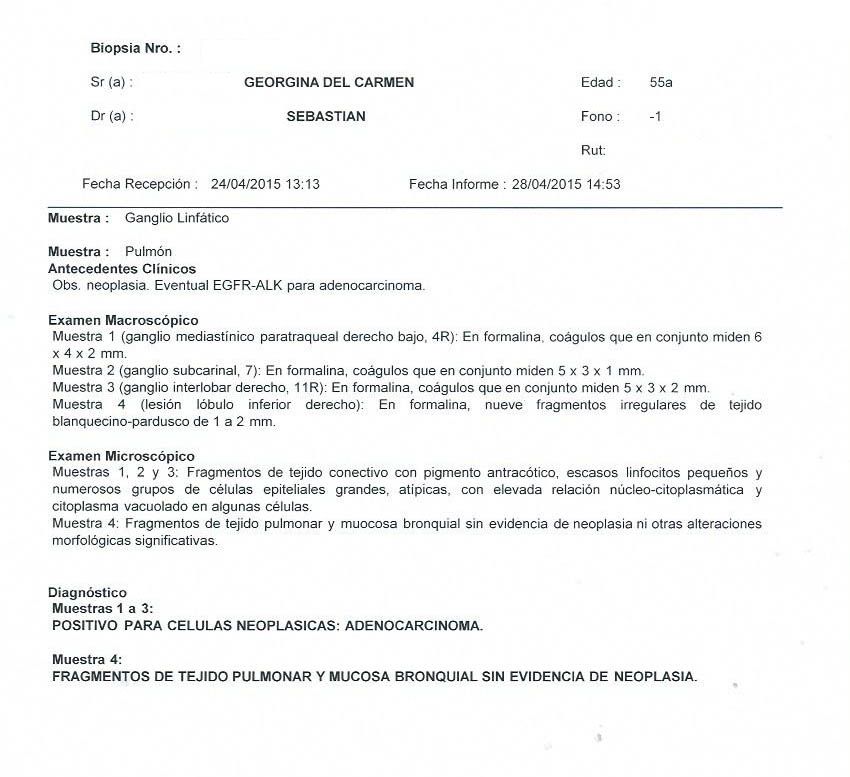 LifEscozul® - Carmen 1 - Cáncer de Pulmon
