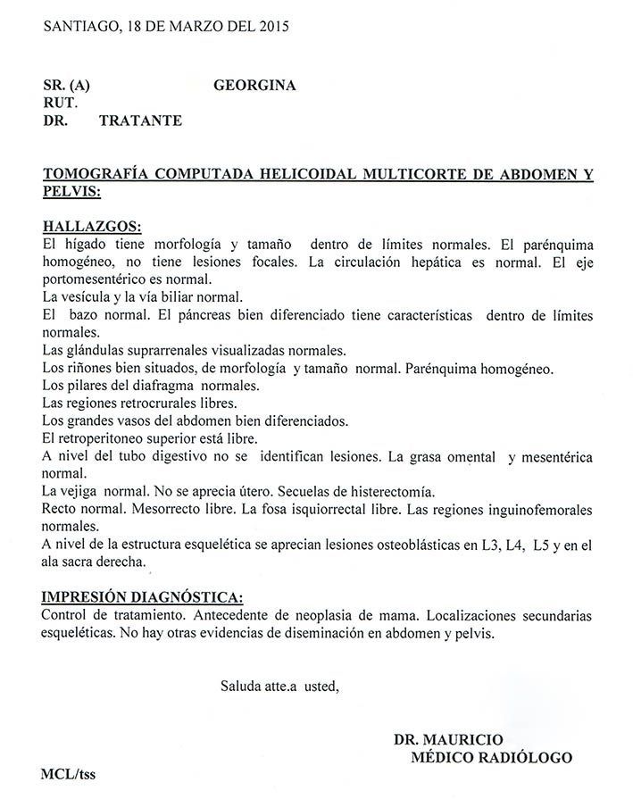 LifEscozul® - Carmen 5 - Cáncer de Pulmon