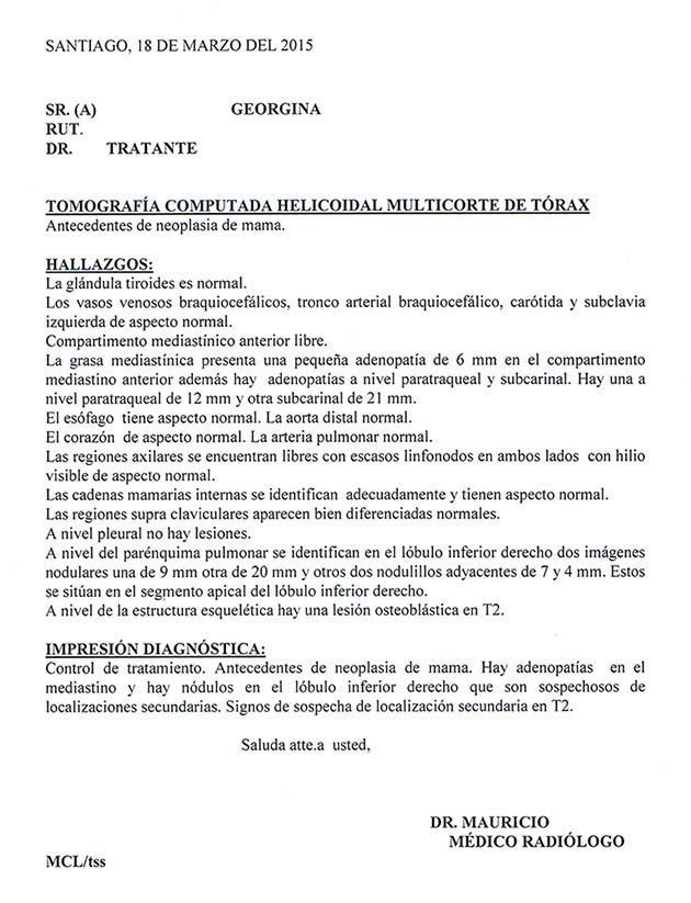 LifEscozul® - Carmen 6 - Cáncer de Pulmon