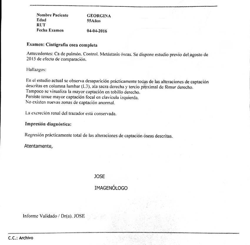 LifEscozul® - Carmen 8 - Cáncer de Pulmon