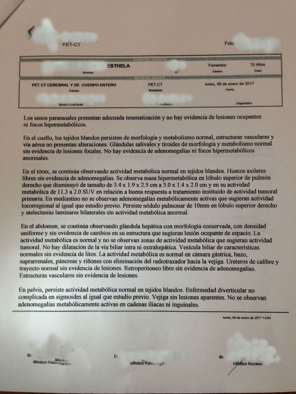 LifEscozul® - Esthela 1 - Cáncer de Pulmon